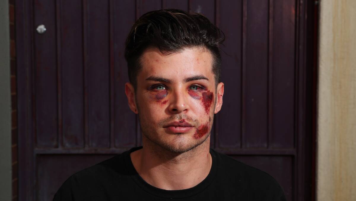 LOW BLOW: Travis Bridle's face is covered in cuts and bruises after a random street attack left him lying on the side of the road in Junee at the weekend. Picture: Emma Hillier