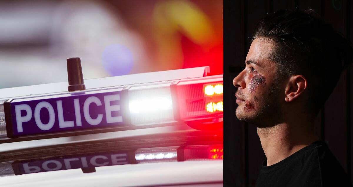 Travis Bridle, 25, has been left with cuts and bruising to his face after an attack in Junee.